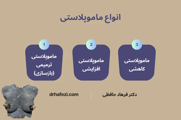 انواع ماموپلاستی