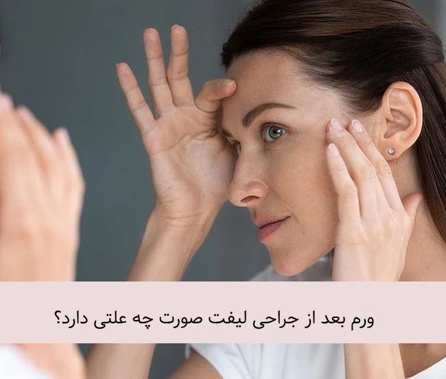 ورم صورت بعد از جراحی لیفت صورت