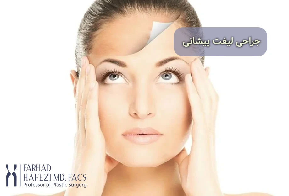 جراحی لیفت پیشانی