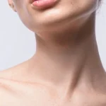 جراحی لیفت گردن