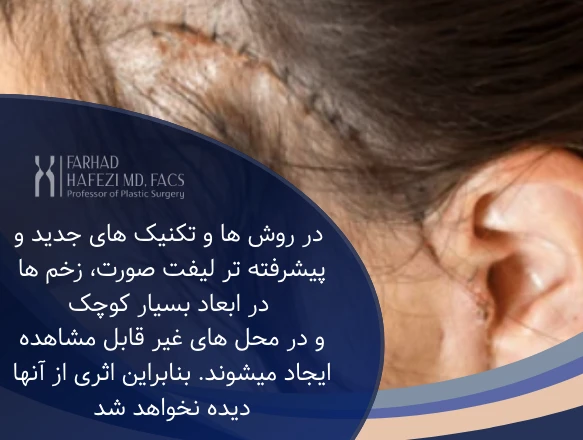 ترمیم جای بخیه جراحی لیفت صورت