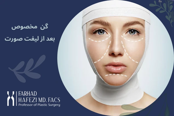 گن بعد از عمل لیفت صورت