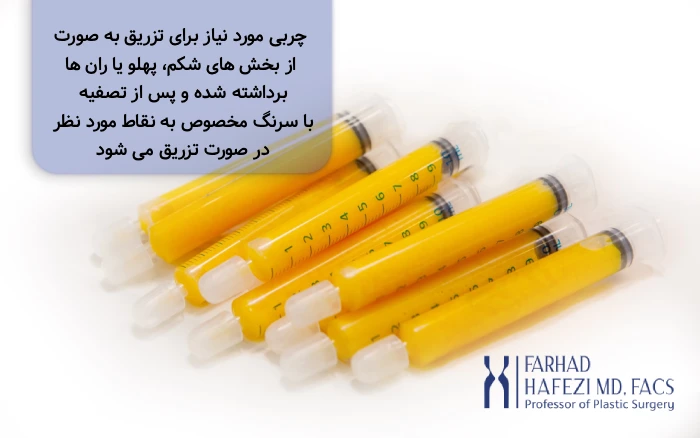 تزریق چربی به صورت