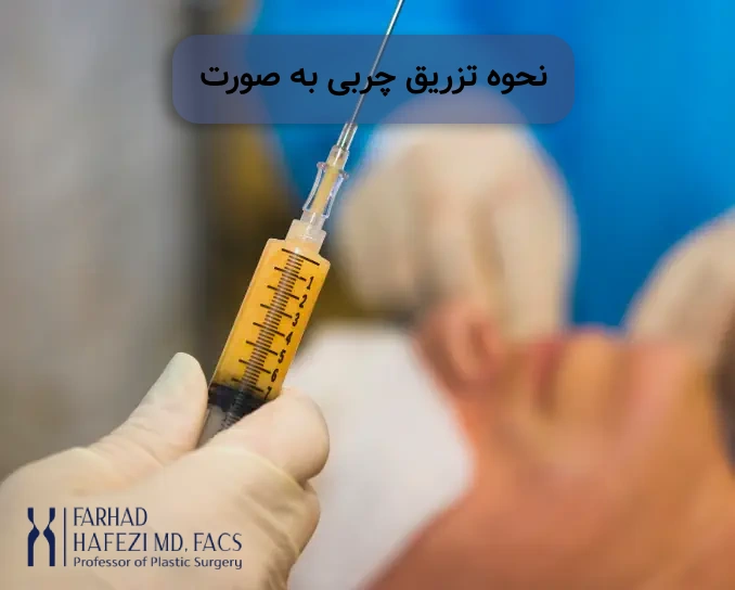 نحوه تزریق چربی به صورت