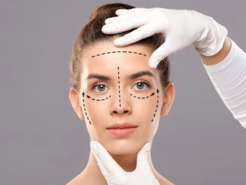 اقدامات قبل از جراحی لیفت صورت