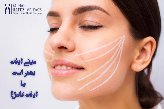 تفاوت لیفت صورت با مینی لیفت