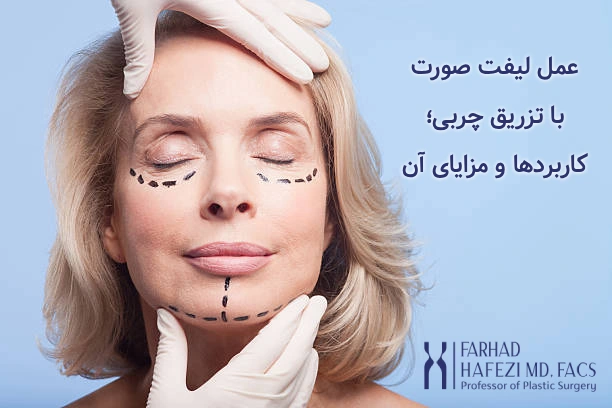 جراحی لیفت صورت همزمان با تزریق چربی