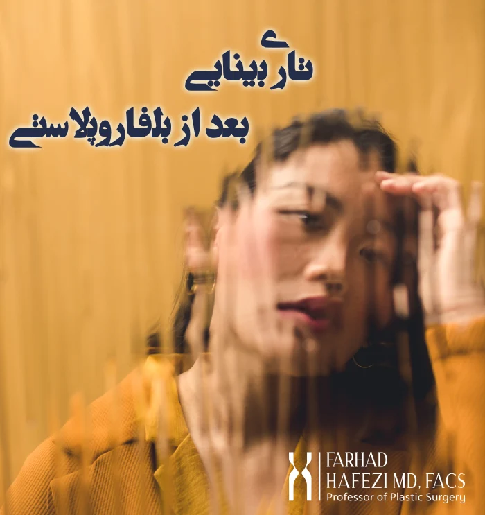 تاری دید بعد از بلفاروپلاستی