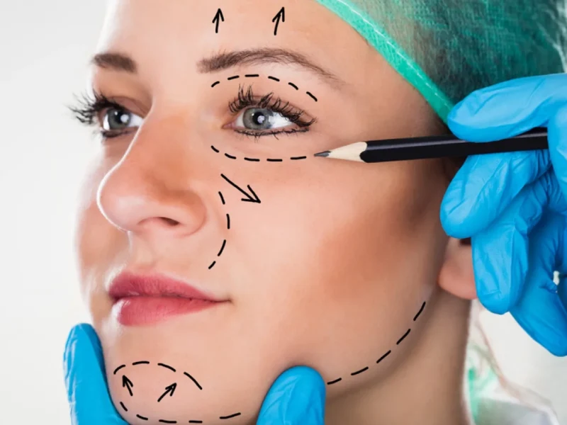 جراحی بینی همزمان با لیفت صورت