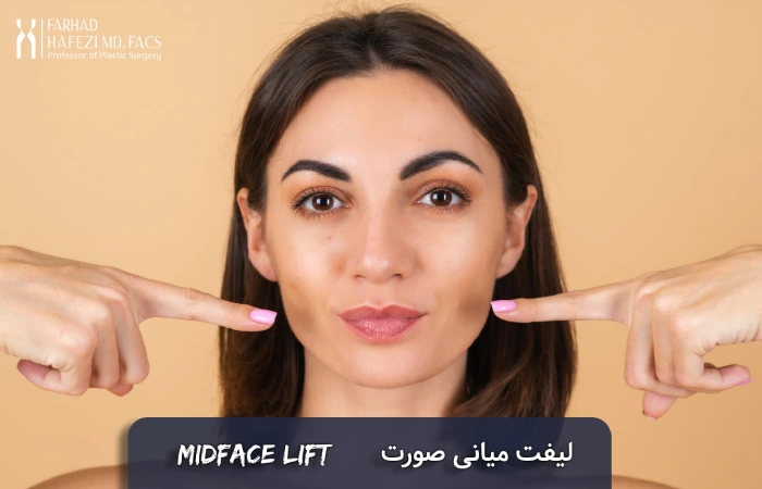 لیفت میانی صورت