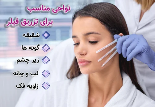 نواحی مناسب برای تزریق فیلر