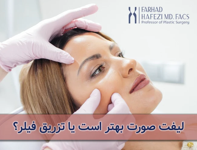 تفاوت لیفت صورت و تزریق فیلر
